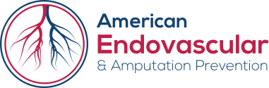 American Endovascular